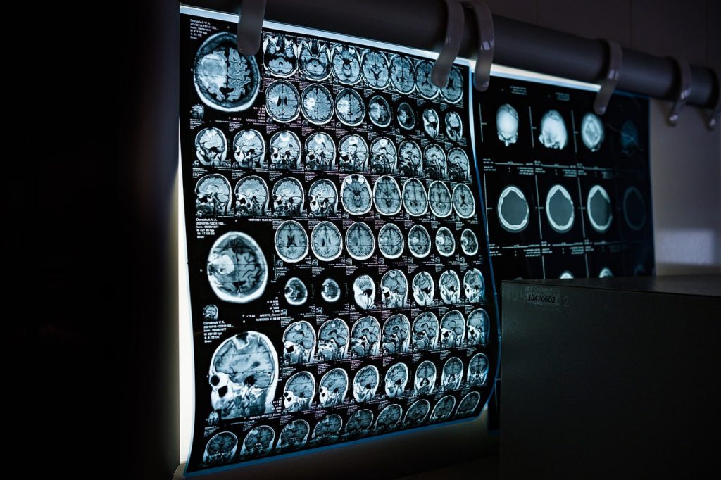 ibd imaging