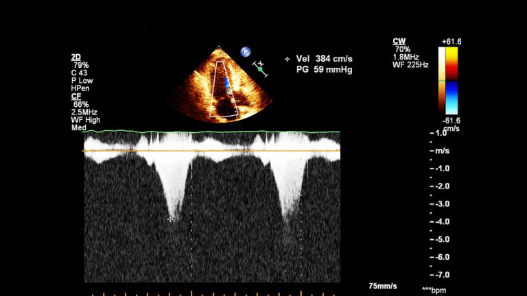 Optoacoustic Imaging