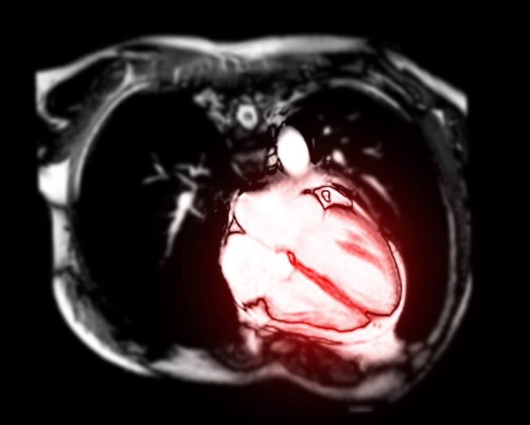 Micro-CT Imaging