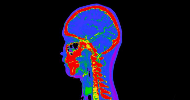 Preclinical imaging